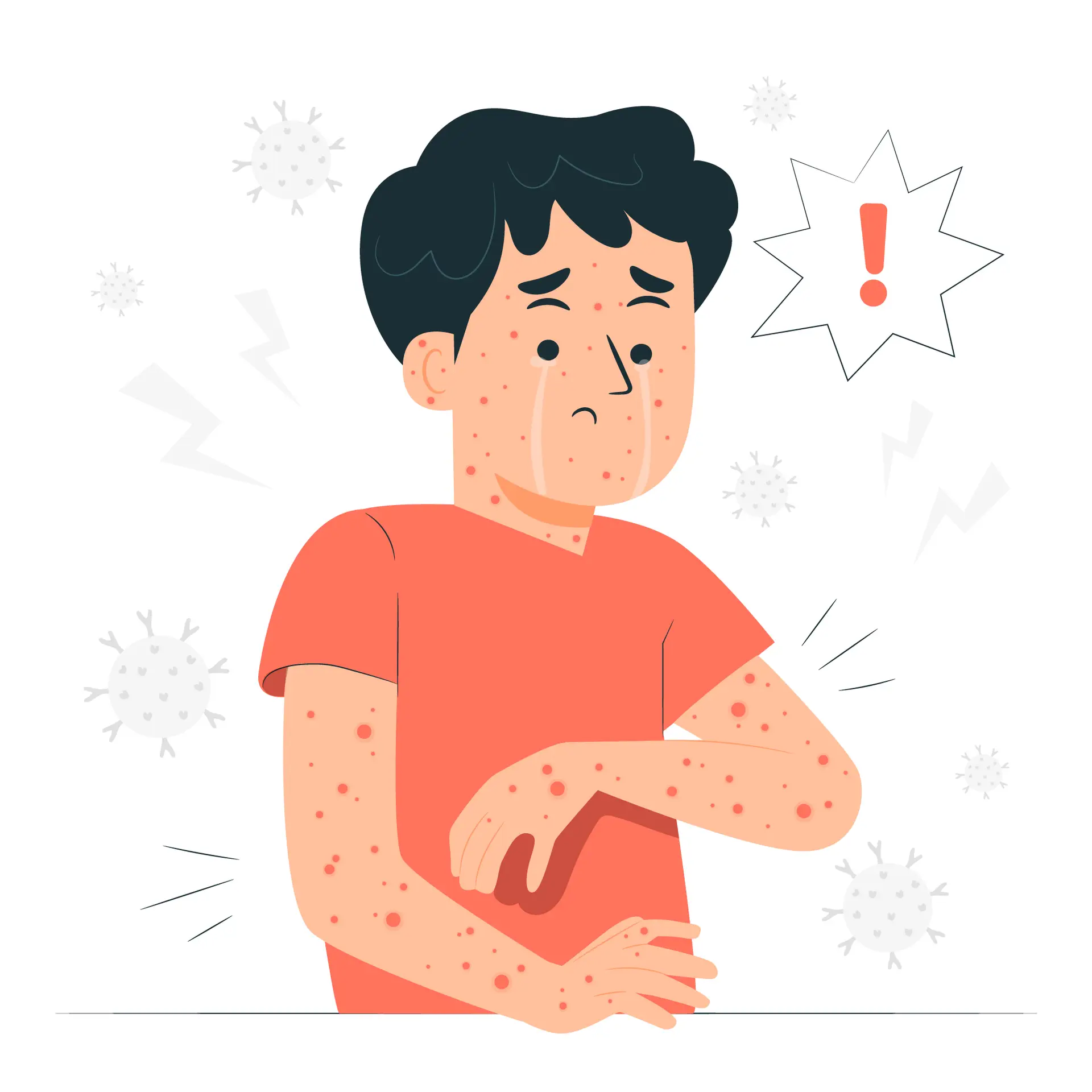 Seboroični dermatitis blog post