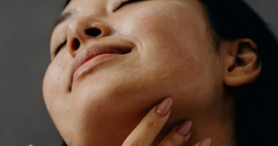 Cervicofacial Rejuvenation